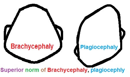 What is Plagiocephaly and how to prevent it